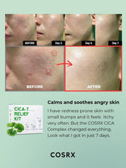 COSRX Pure Fit Cica7 Relief Kit